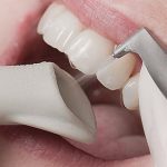 Отбеливание и чистка зубов Air flow 